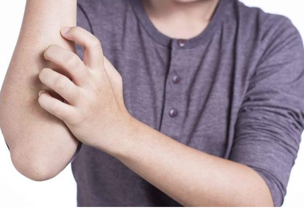 如何應(yīng)對(duì)秋冬季節(jié)皮膚干燥瘙癢