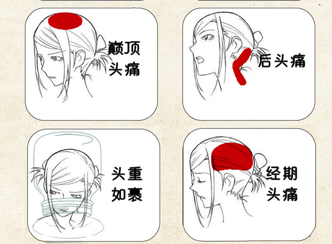 不同頭痛類型經(jīng)絡(luò)護(hù)理方法，廣西中醫(yī)美容培訓(xùn)